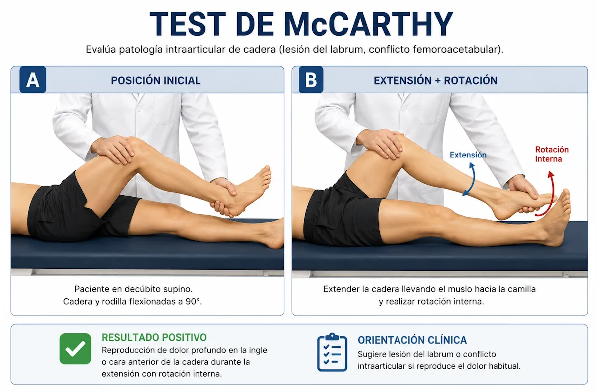Test de McCarthy