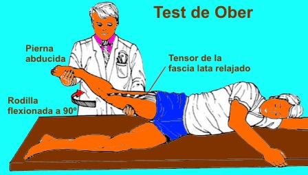 Prueba de Ober - Paso 1