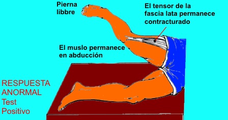Prueba de Ober - Paso 3