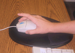 Tendinitis por extensión repetitiva