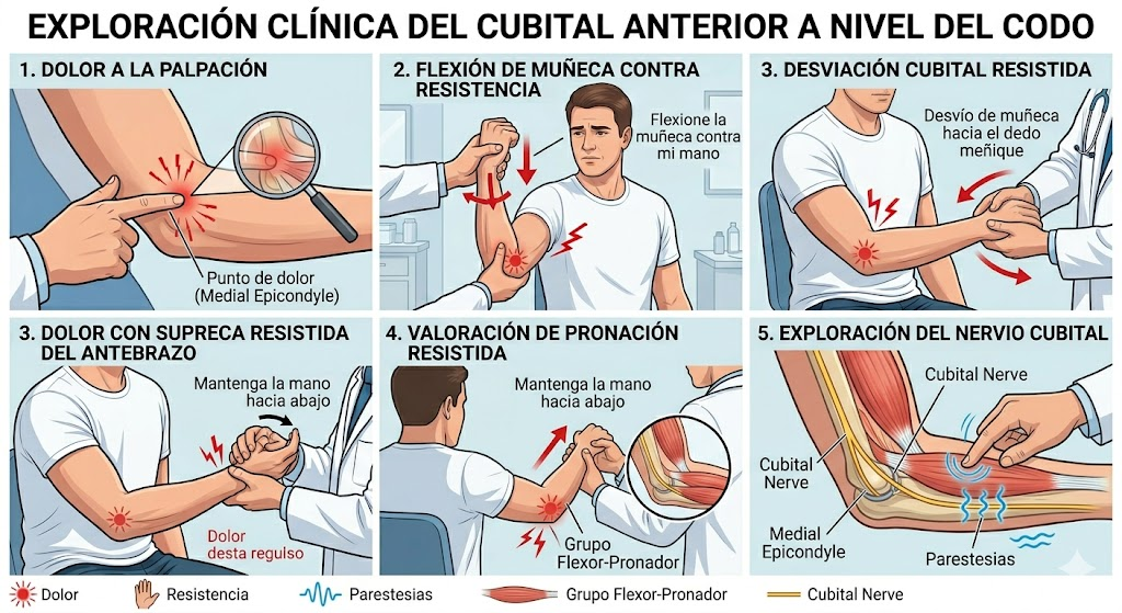 Exploración clínica de la tendinitis del cubital anterior en el codo
