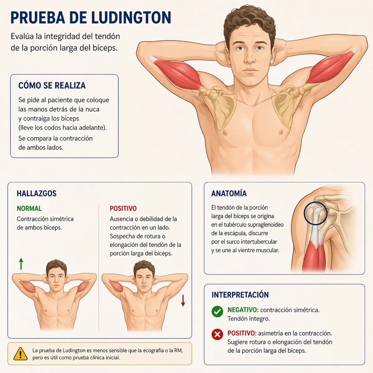 Prueba de Ludington