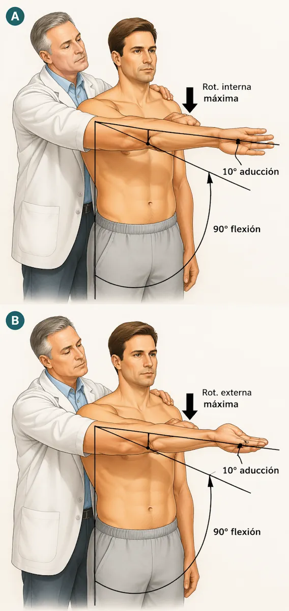 Prueba de O'Brien del hombro