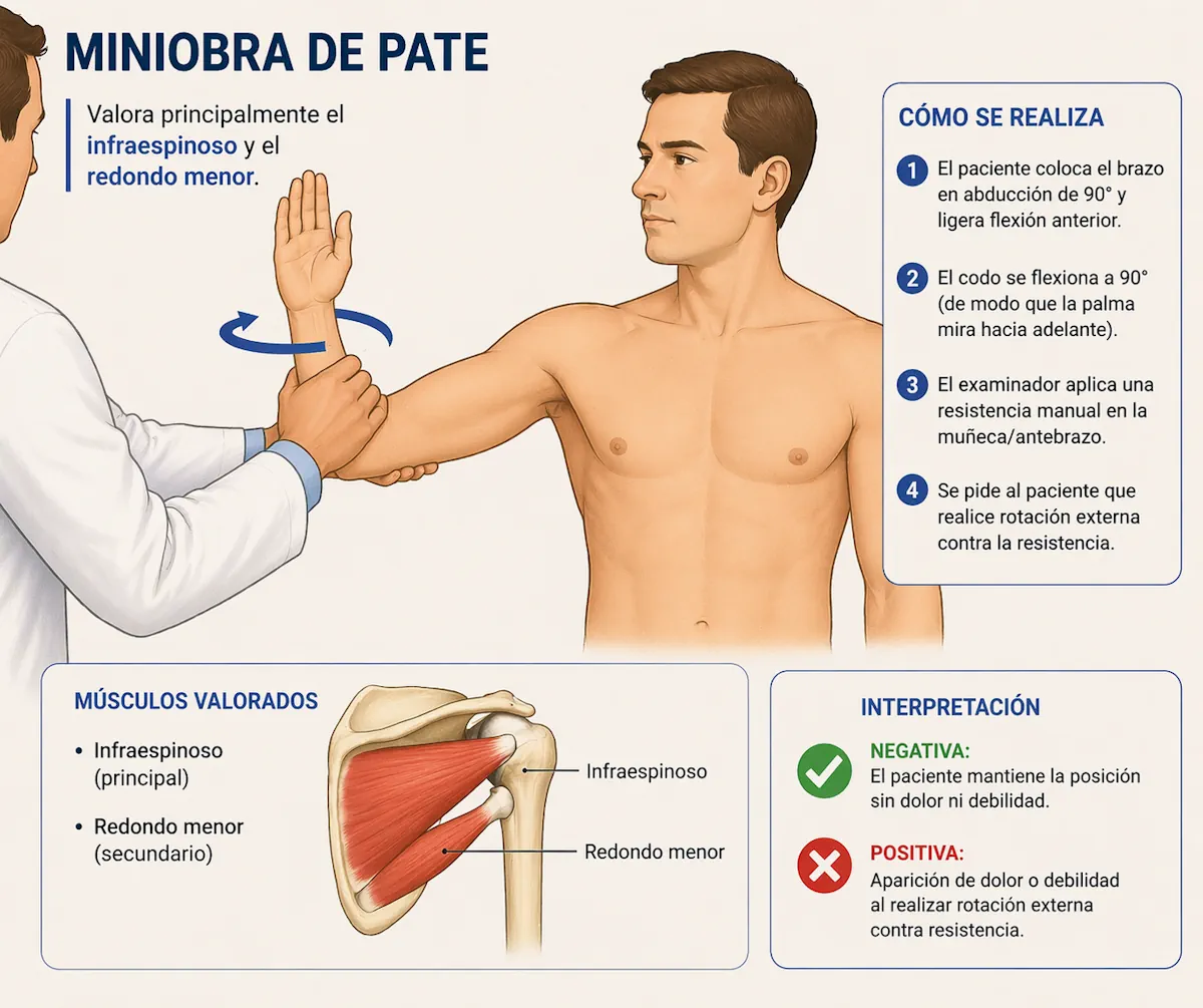 Maniobra de Patte