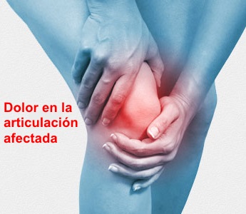 Radiografía artrosis