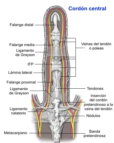 Cuerda central en enfermedad de Dupuytren