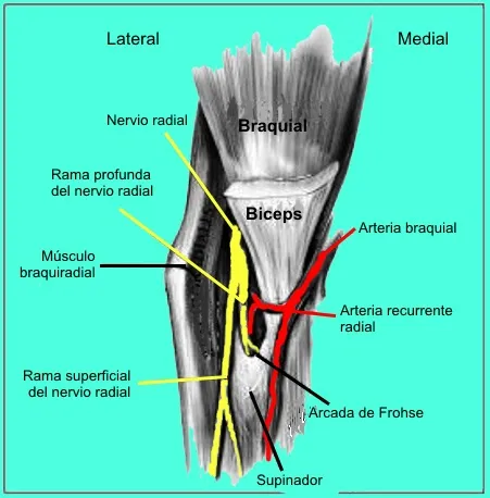 Síndrome del túnel radial