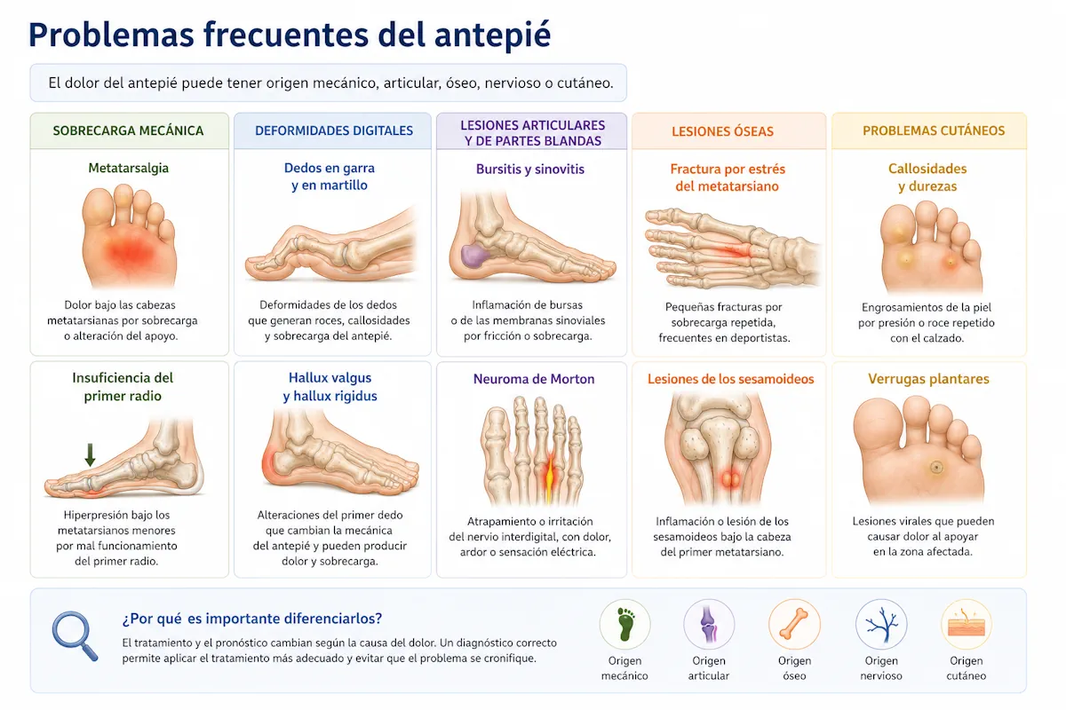 Problemas frecuentes del antepié