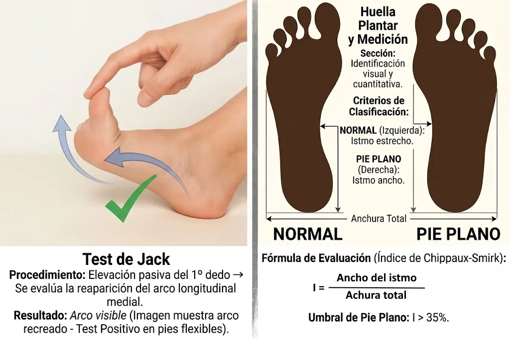Test de Jack e índice de Chippaux-Smirak