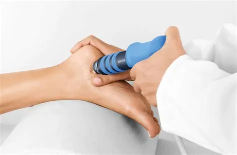 Ondas de choque para fascitis plantar