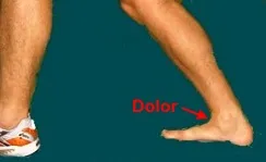 Exploración de la dorsiflexión en pinzamiento anterior del tobillo
