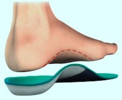 Plantillas ortopédicas