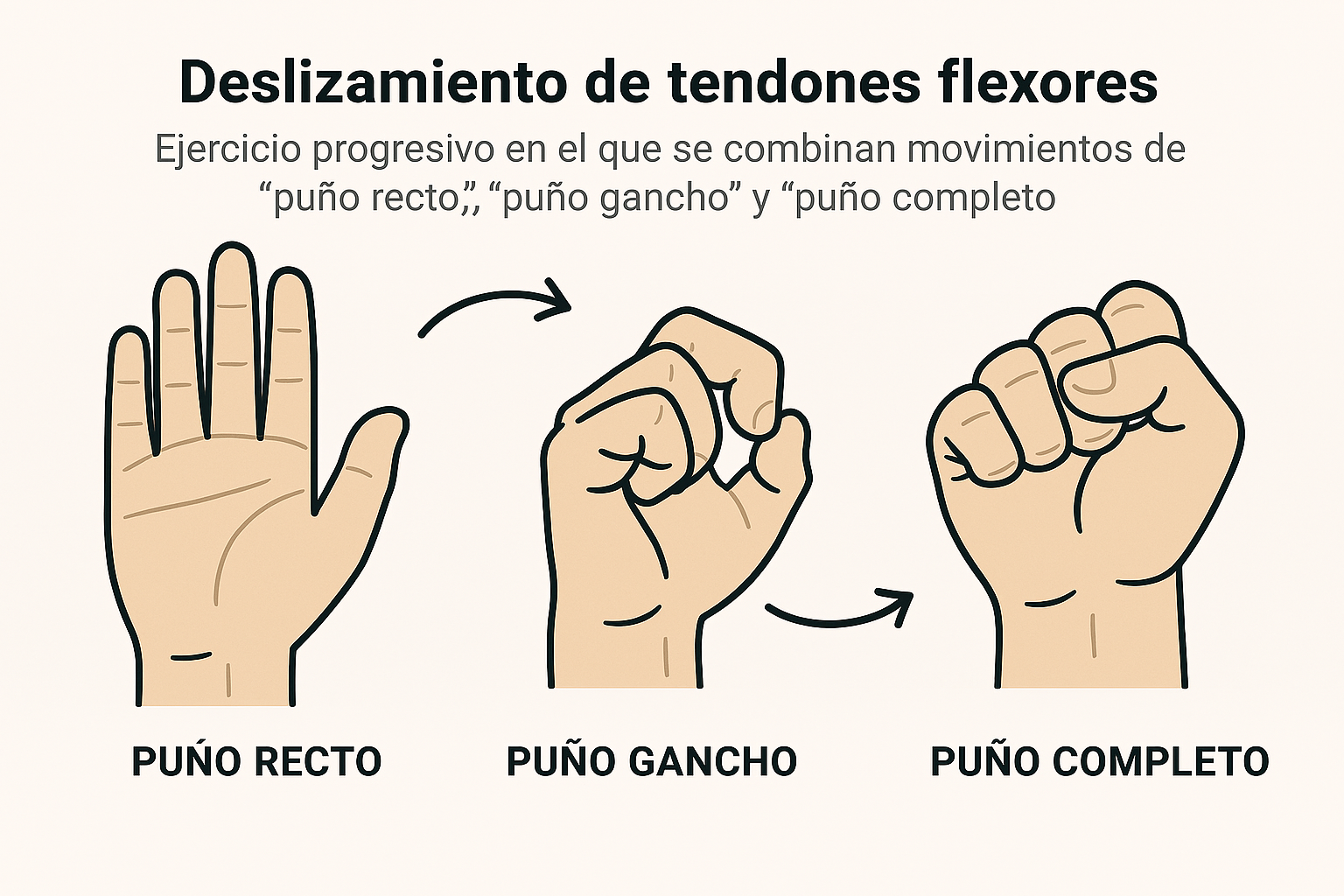 Deslizamiento de tendones flexores