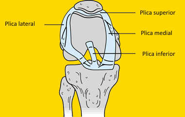 Tipos de plica sinovial en la rodilla