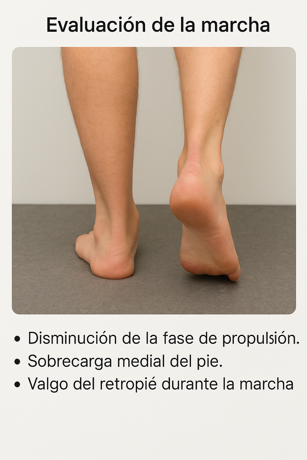 Analisis de la marcha en la isnsuficiencia del tibial posterior