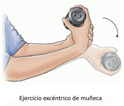 Ejercicio excéntrico de muñeca