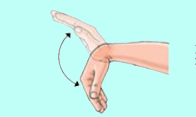 Movilización nervio radial