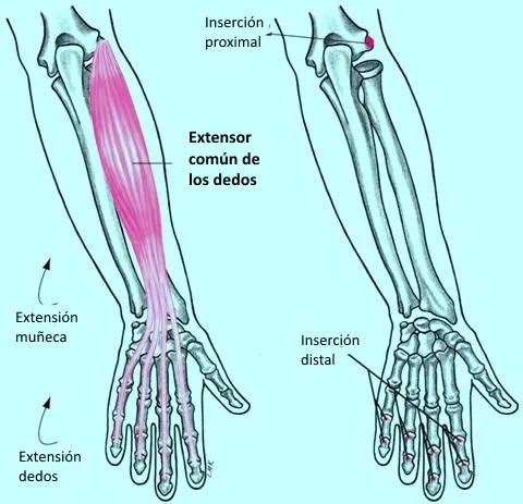Extensor común de los dedos